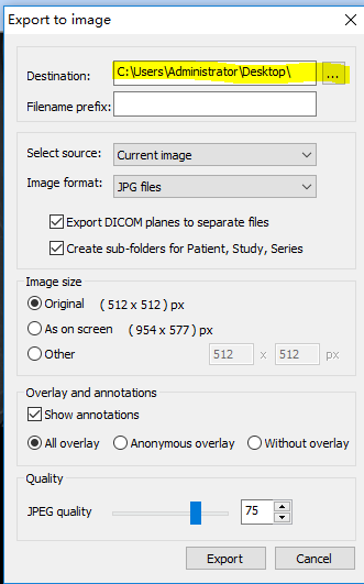 MicroDicom v3.4.7 官方版